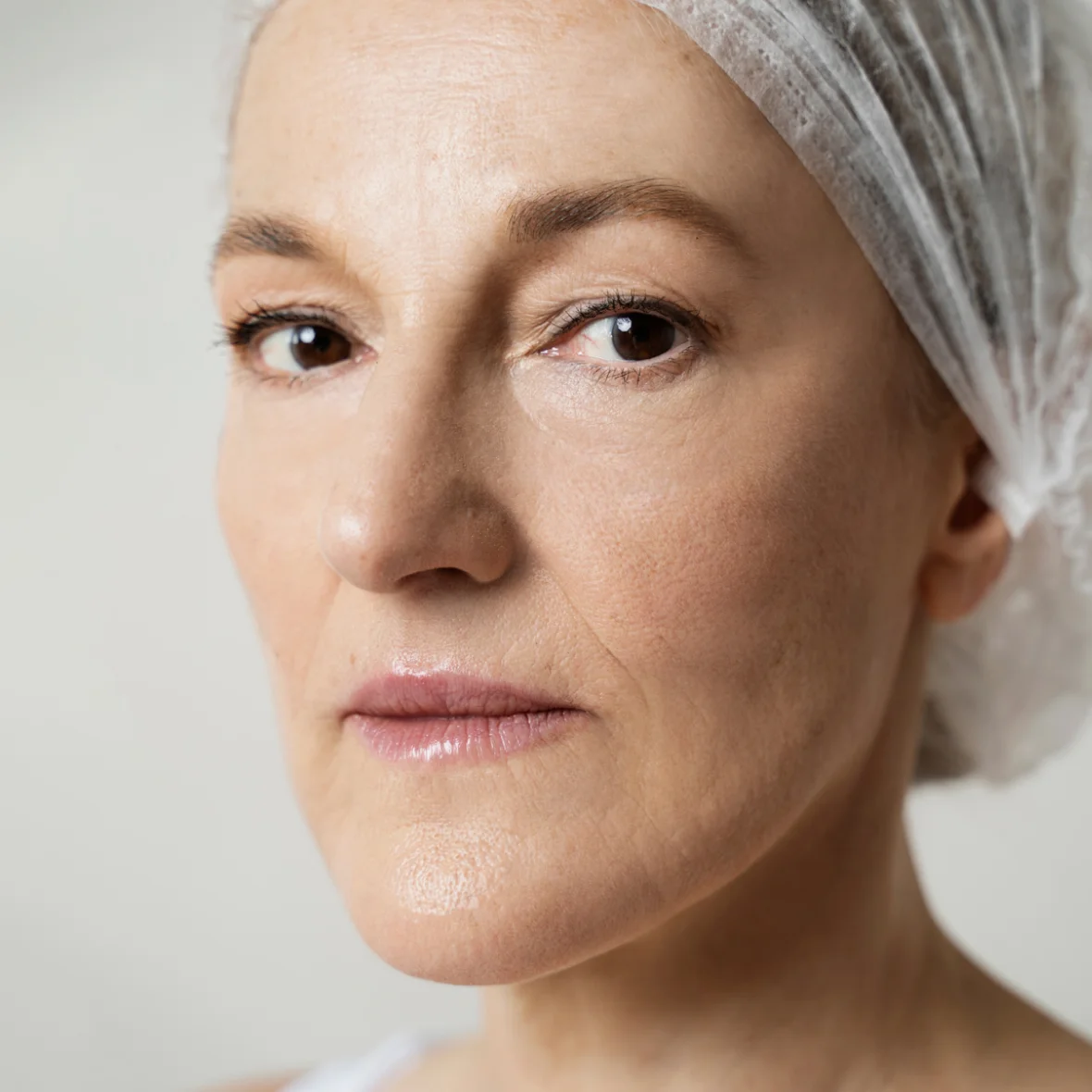 Botox Festus MO - Natural Results