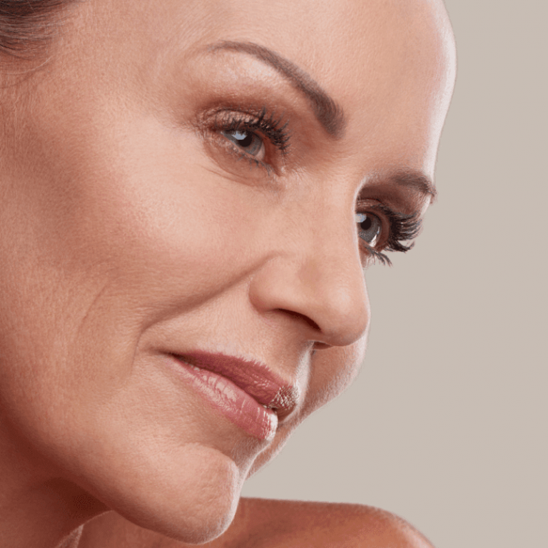 Dermal Fillers